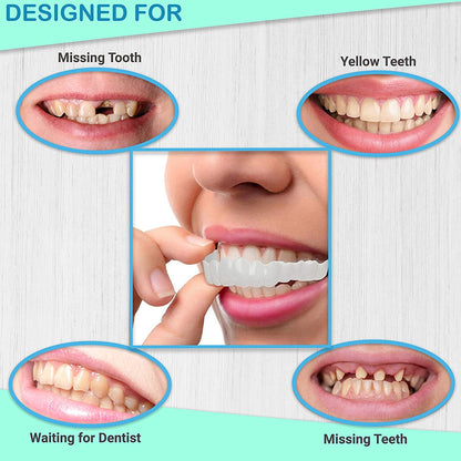 Denture Kit for Improving Smile | Temporary Teeth Repair Kit