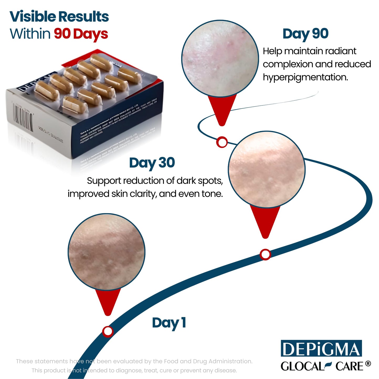 GlocalCare Depigma Support Reduction of Hyperpigmentation, Melasma & Dark Spots with Glutathione, Polypodium Leucotomos, Grape Seed & Marigold Extract