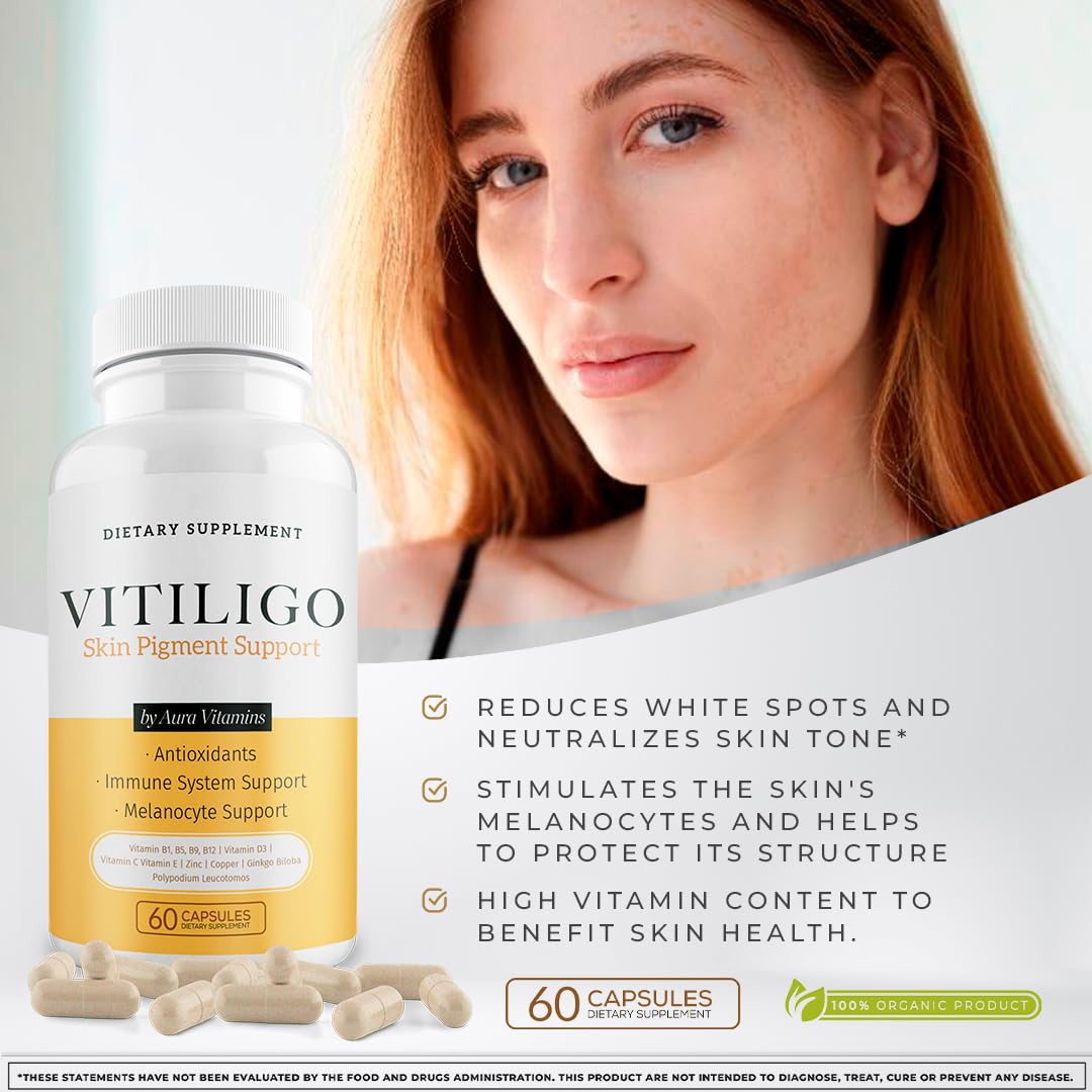 Dermawonder Vitiligo Capsules 60 Count - Support Pigmentation & Reduce White Spots