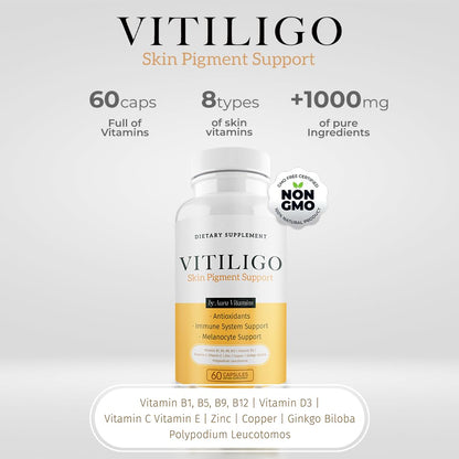 Dermawonder Vitiligo Capsules 60 Count | Effective Pigmentation Support & White Spot Reduction