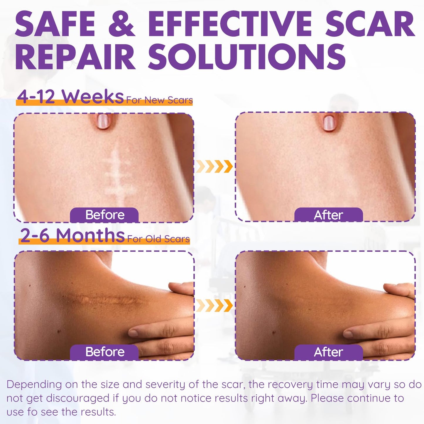 DFK Silicone Scar Sheets & Tape – Reusable Soft Hospital-Grade Silicone (1.6x79 in Roll)