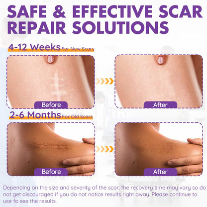 DFK Silicone Scar Sheets & Tape – Reusable Soft Hospital-Grade Silicone (1.6x79 in Roll)