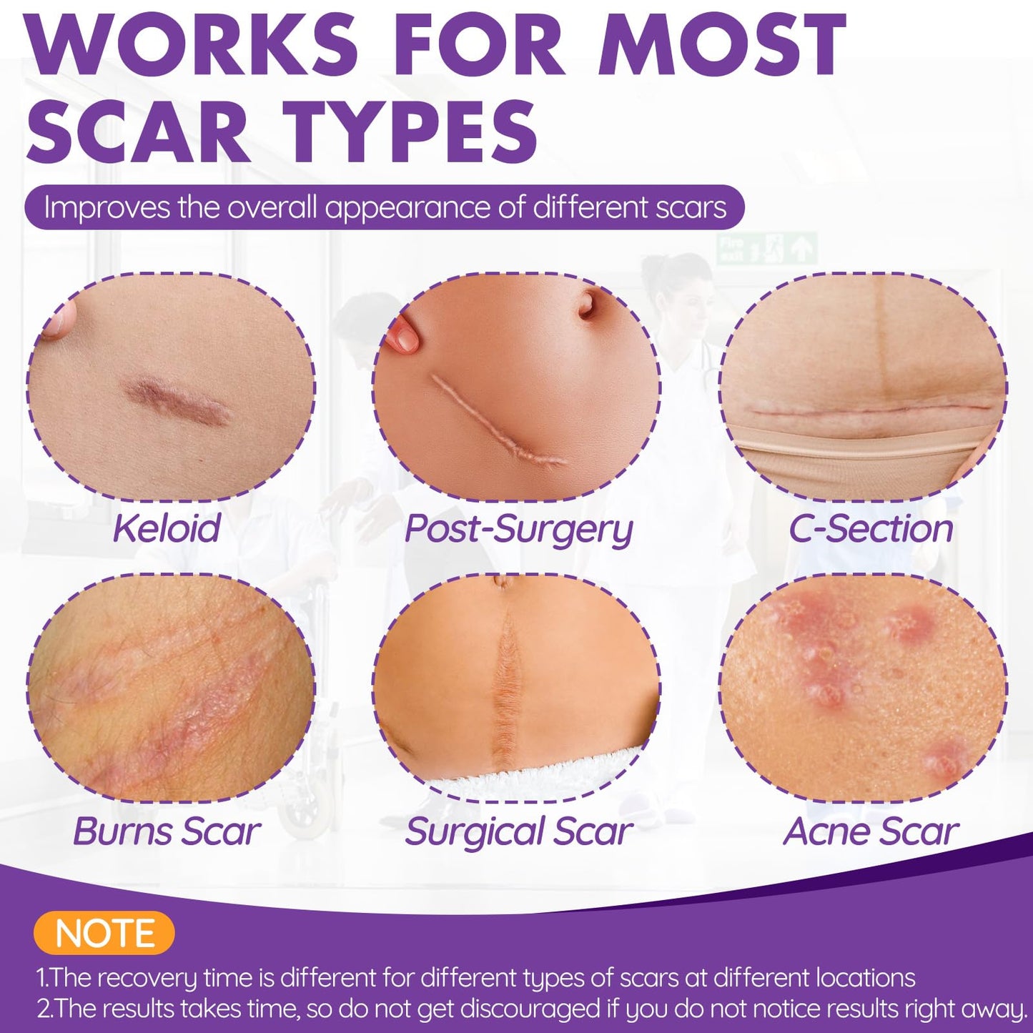 DFK Silicone Scar Sheets & Tape – Reusable Soft Hospital-Grade Silicone (1.6x79 in Roll)