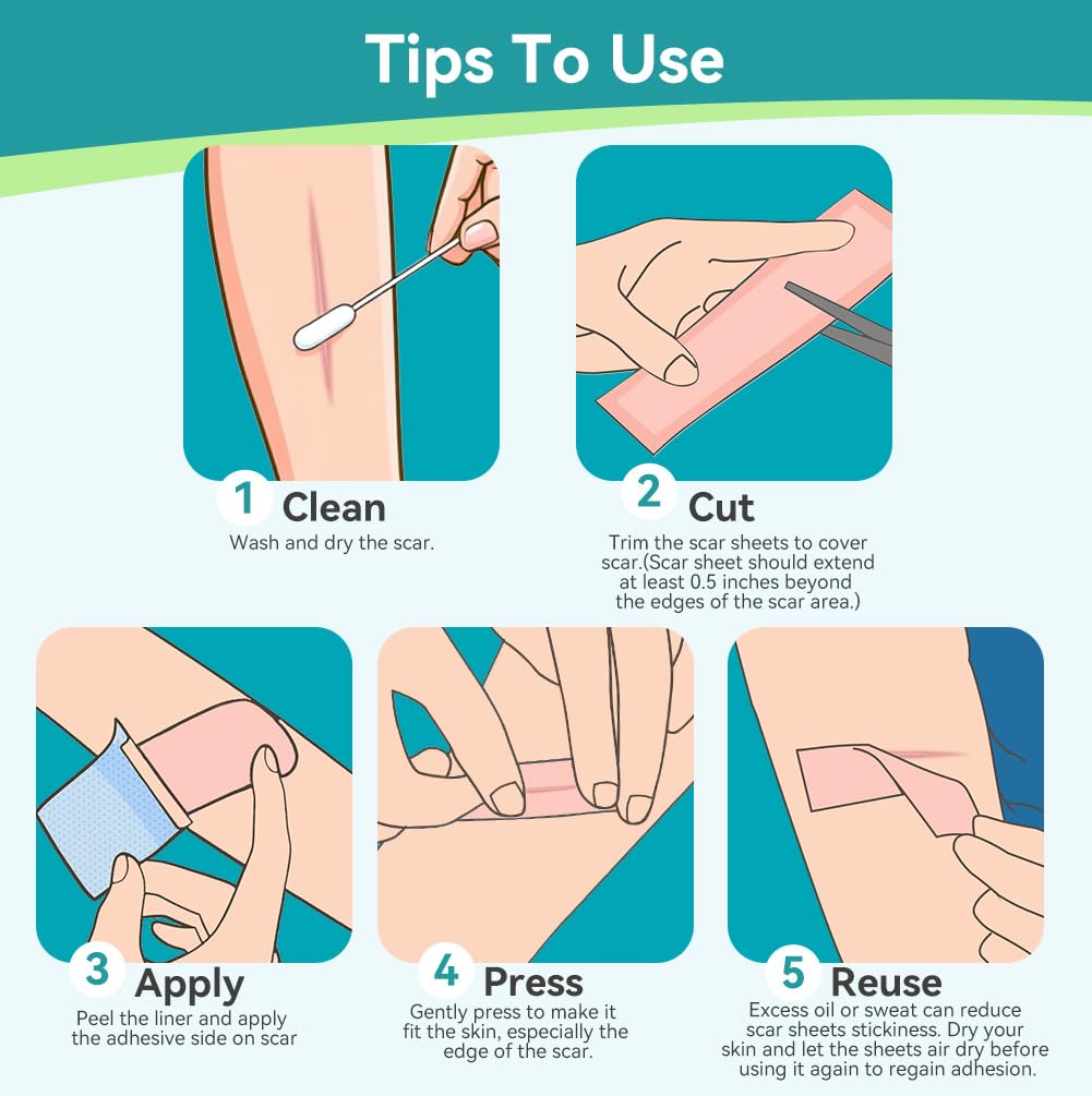 Dimora Medical Grade Silicone Scar Sheets - Ultra Soft Waterproof Scar Tape (1.6x120 Roll)