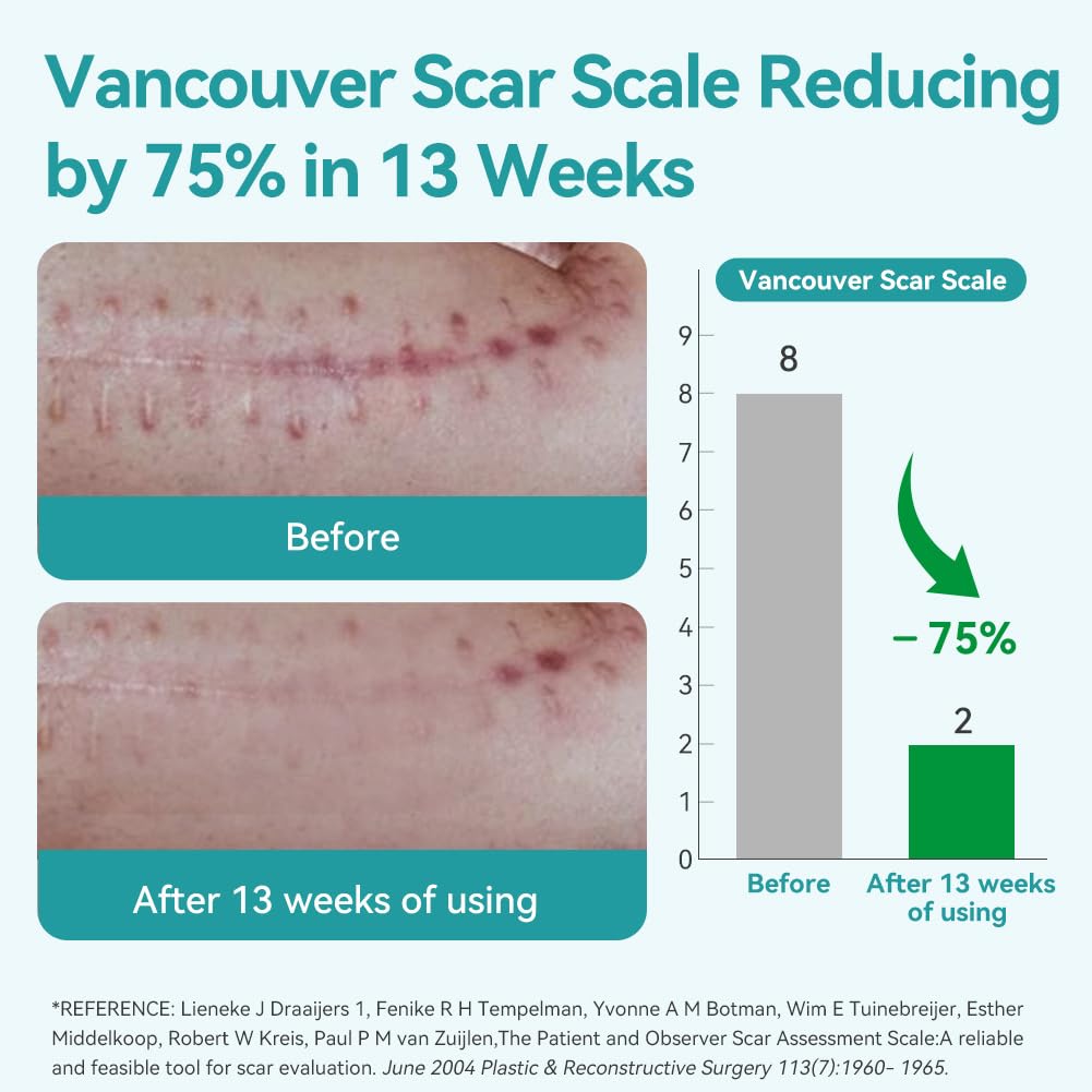 Dimora Medical Grade Silicone Scar Sheets — Ultra Soft Scar Tape (1.6x60 in), Hypoallergenic & Sensitive-Skin Safe