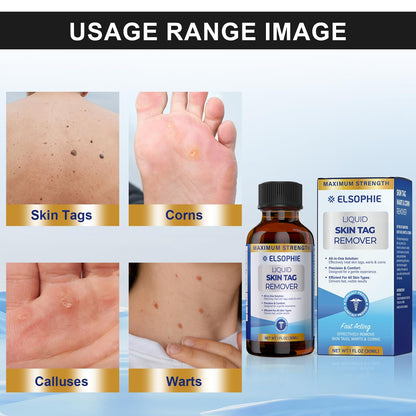 Elsophie Fast-Acting Skin Tag Removal Freeze Away – Maximum Strength Salicylic, All-in-One 30 ml