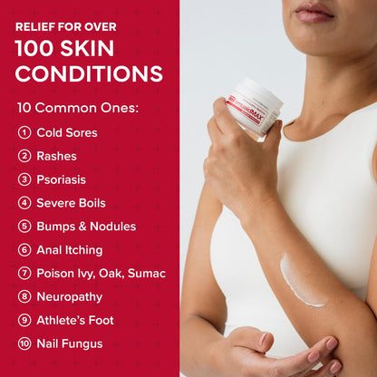 EMUAIDMAX Ointment - Maximum Strength Itch Relief for Skin Conditions