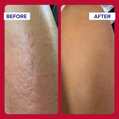EMUAIDMAX Ointment - Maximum Strength Itch Relief for Skin Conditions