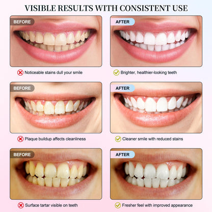 Niacinamide Whitening Toothpaste – Enamel Repair, Stain Removal (2 PCS)