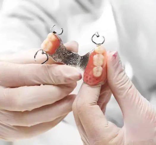 Fake Teeth Gum Material for Temporary Dentures - DIY Tooth Fix Kit (Light Pink)