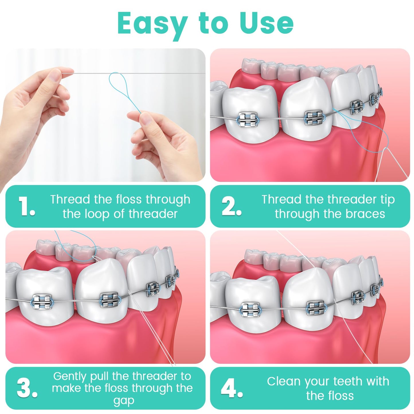 Floss Threaders - 400 Count (Pack of 4) for Braces, Bridges & Implants