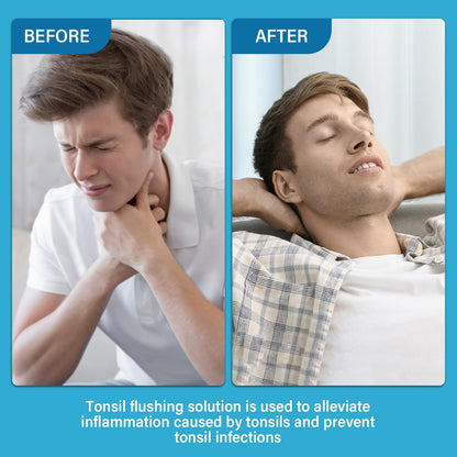 Tonsil Stone Remover Mouthwash - Natural Ingredients, Soothes Tonsils & Fresh Breath (Mint)
