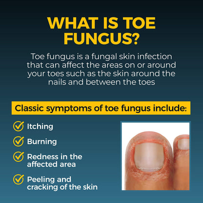 Fungi-Nail Anti-Fungal Liquid Solution – Tolnaftate 1% (Pack of 2, 1 oz Each)