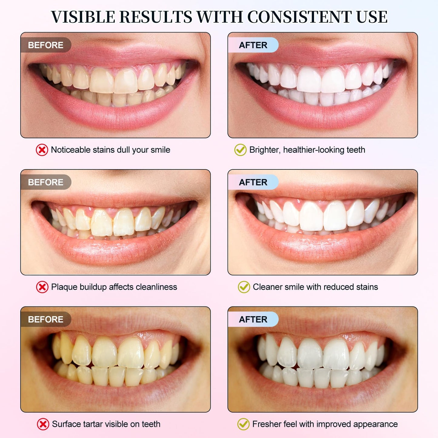 Niacinamide Whitening Toothpaste 2 Pack – Enamel Safe, Fresh Mint & Peach