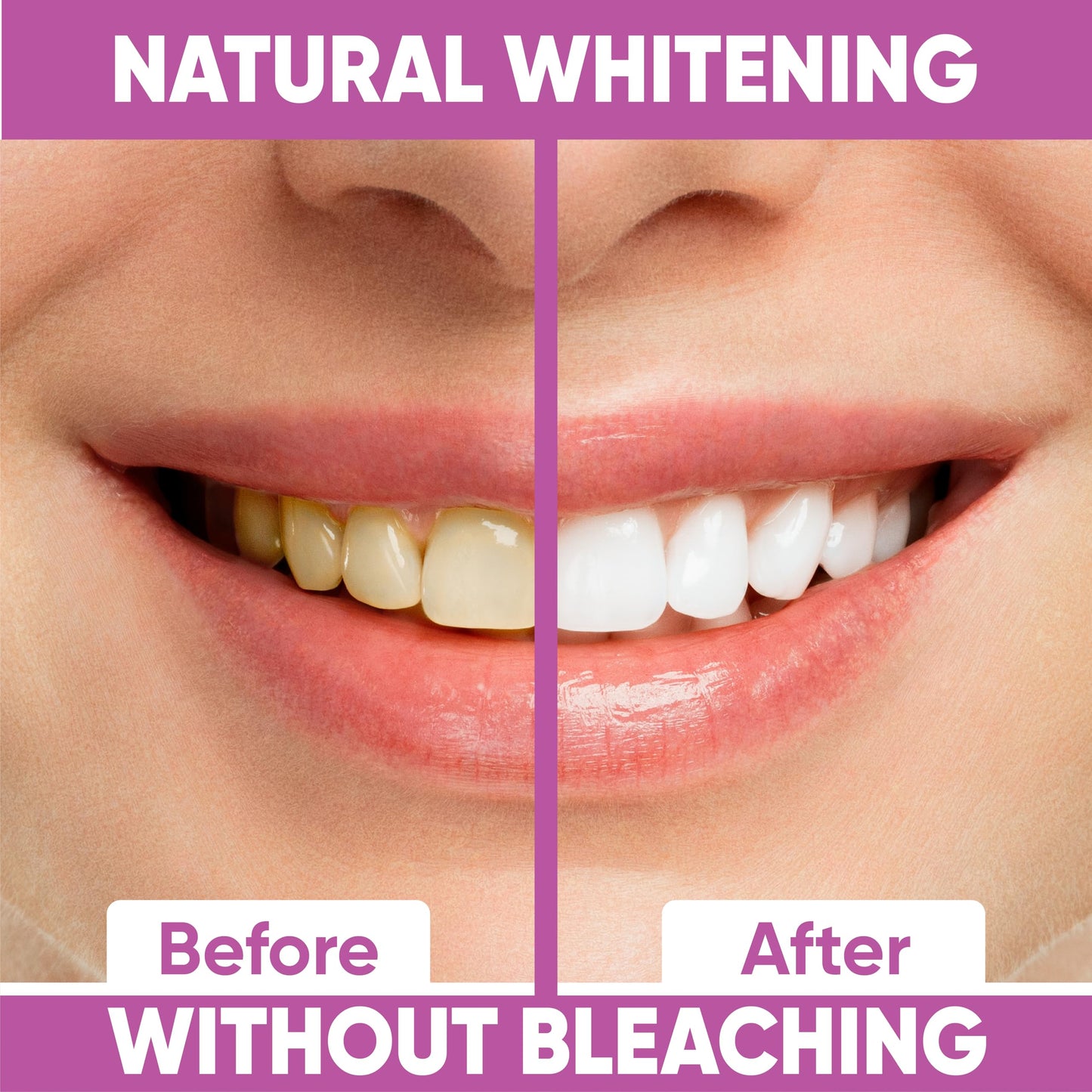Gentle Teeth Whitening Strips - 28 Stripes | Peroxide-Free Whitening