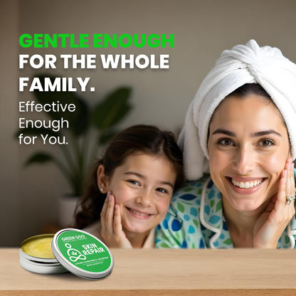 Green Goo Skin Salve | Natural Skin Repair & Daily Moisture – 1.82 oz Large Tin
