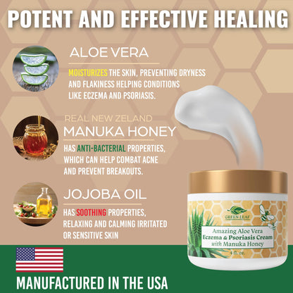 Green Leaf Naturals Manuka Honey Eczema Cream – Moisturizing Lotion for Dry Skin, Psoriasis Relief (16oz)