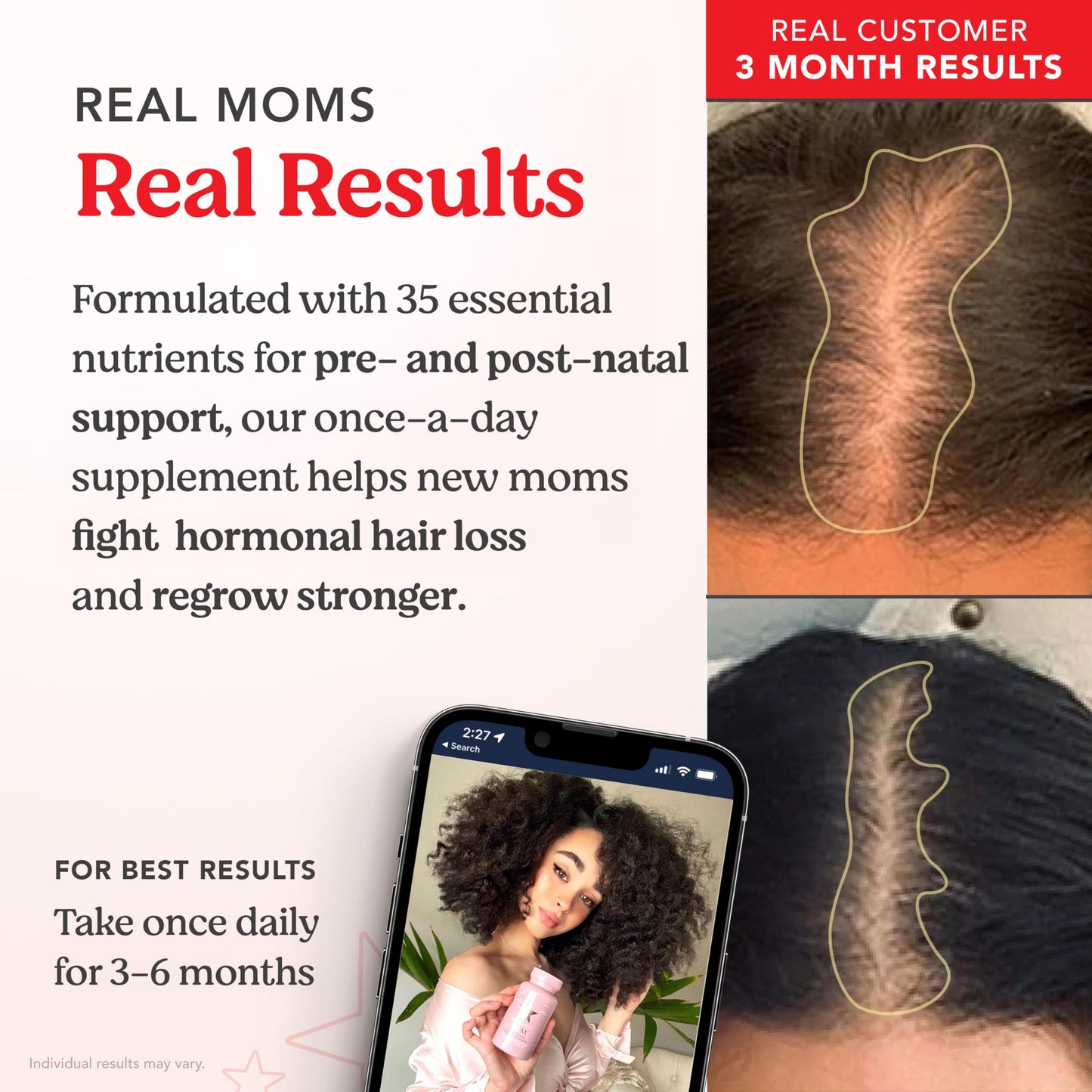 HAIRtamin MOM – Vegan Prenatal & Postnatal Hair Vitamins for Pregnancy & Breastfeeding