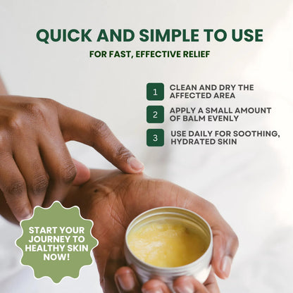 KESMEDIK Tea Tree Oil MaxTherapy Balm — Itchy Skin Relief for All Ages