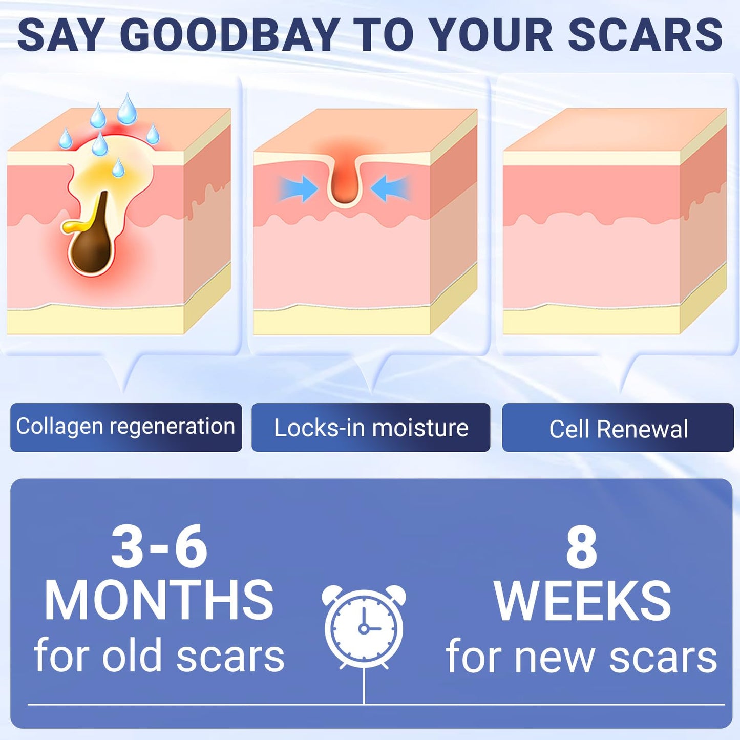 Kunyle Scar Cream | Silicone Scar Gel for Surgical Scars, Keloids & Stretch Marks | 60g