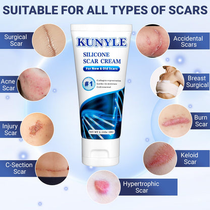 Kunyle Scar Cream | Silicone Scar Gel for Surgical Scars, Keloids & Stretch Marks | 60g
