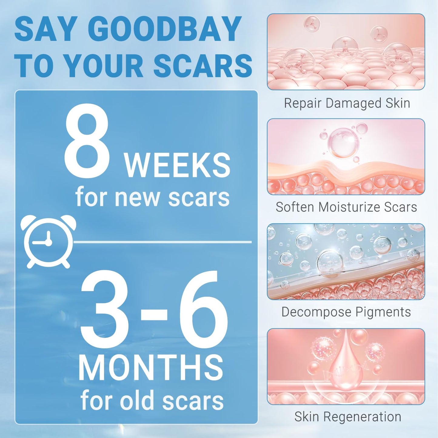 Kunyle Silicone Scar Gel – Advanced Scar Cream for Surgical Scars, Stretch Marks & Keloids (60g)