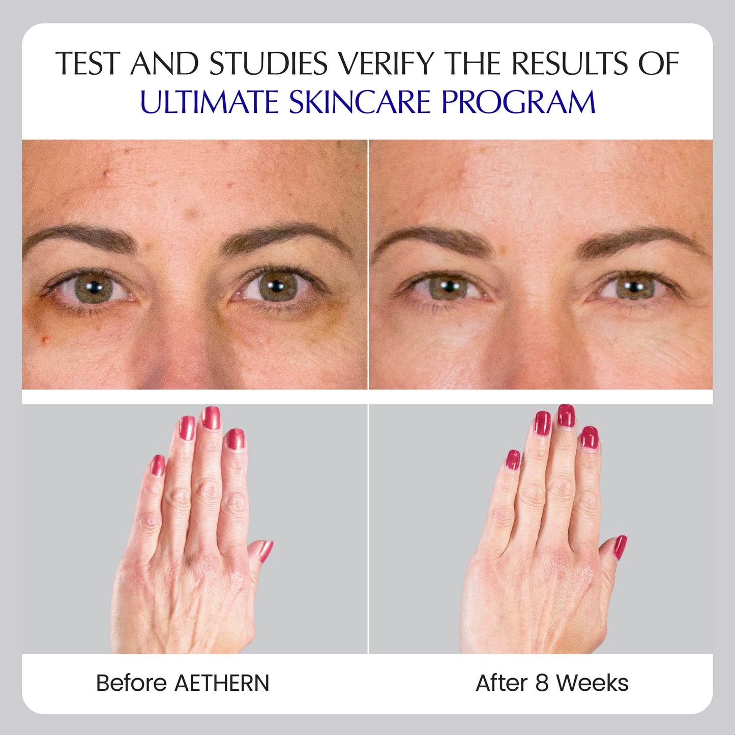 Liquid Skin Care Supplement with Collagen + Hyaluronic Acid – Ready-to-Drink, Clinically Proven for Glowing, Hydrated, and Firm Skin | UV Protection | 28 Servings | Ultimate Skincare Program