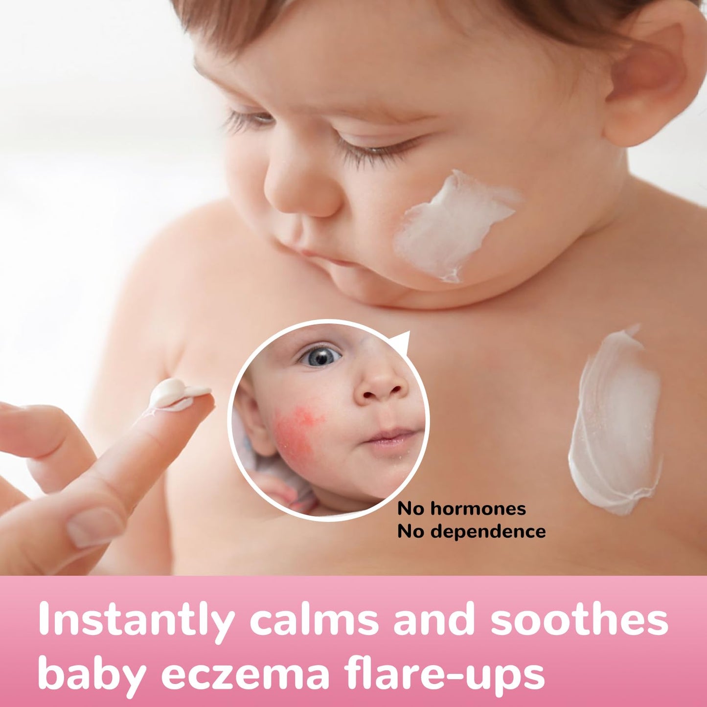 LMNOOP Baby Eczema Relief Cream | All-Natural Herbal Formula 3.53oz