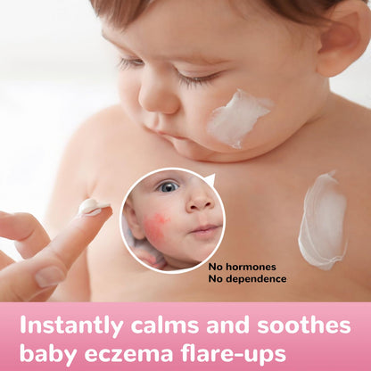 LMNOOP Baby Eczema Relief Cream | All-Natural Herbal Formula 3.53oz