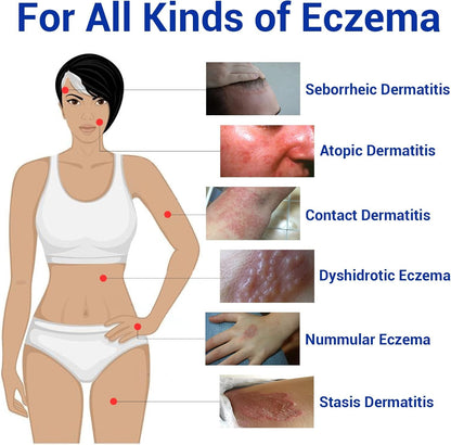 LMNOOP Eczema Cream - Maximum Strength Relief for Dry, Itchy Skin (7.05oz)