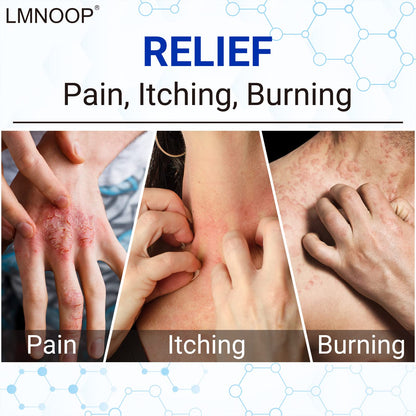 LMNOOP Eczema Cream | Maximum Strength Relief for Itchy, Dry Skin (1.76 oz)