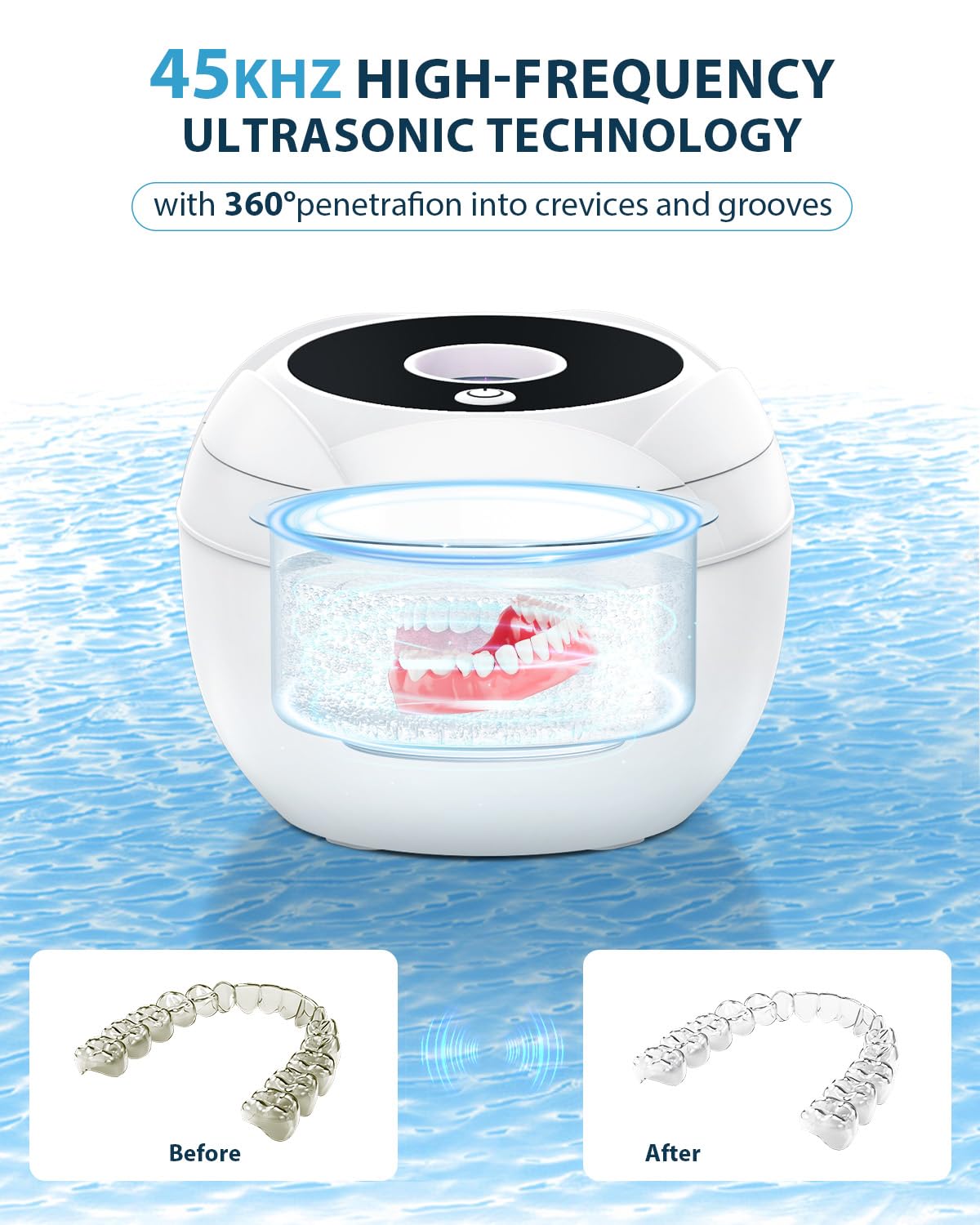 Lumiflexa Ultrasonic Retainer Cleaner – 45kHz, 4 Modes, 200ml Dental Pod (White)