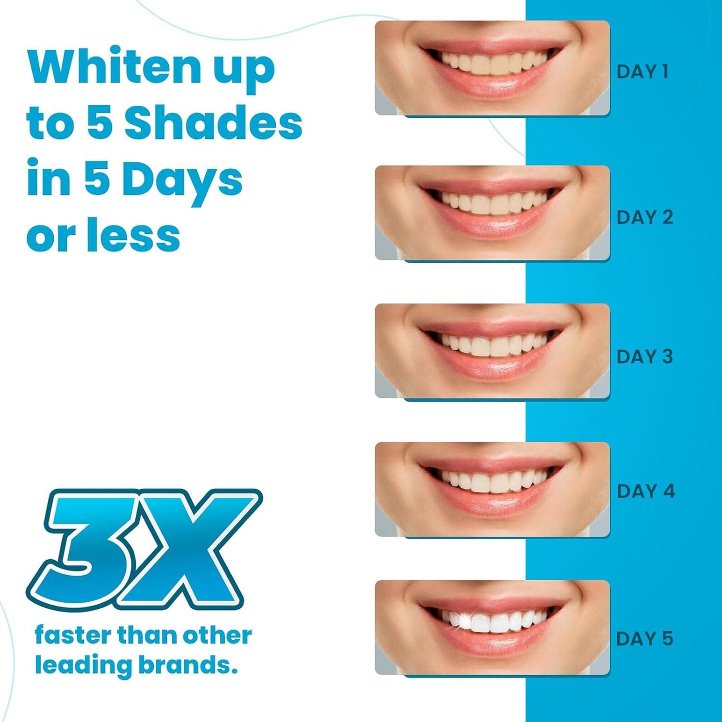 Lumist Teeth Whitening Strips – 10 Strips (5 Treatments), Mint, Sensitive Teeth