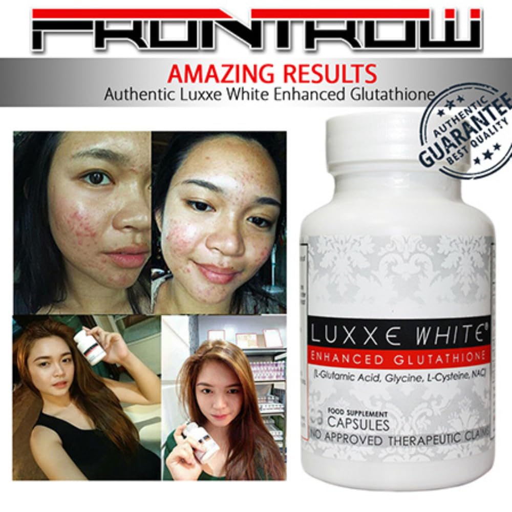 Luxxe White – Glutathione, Vitamin C & Alpha Lipoic Acid for Radiant Skin