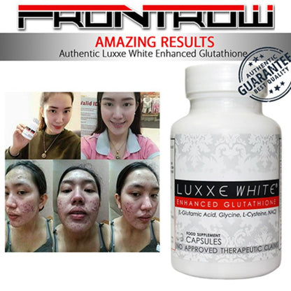 Luxxe White – Glutathione, Vitamin C & Alpha Lipoic Acid for Radiant Skin