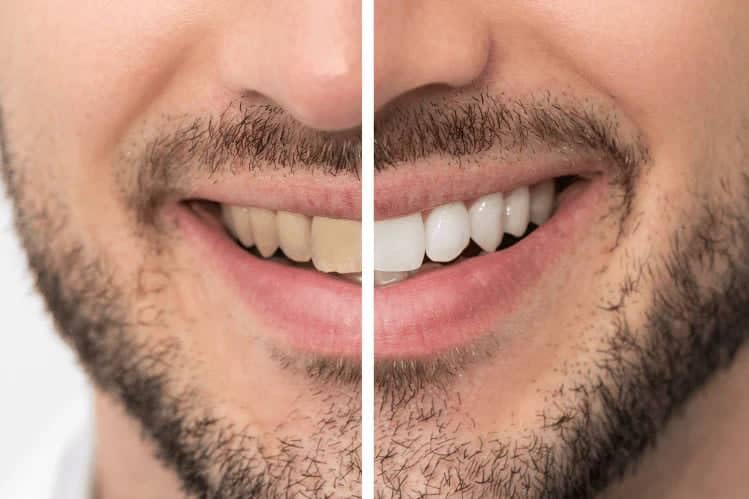 Marvs Smokers Toothpaste – Whitening for Tobacco & Coffee Stains | 85ml