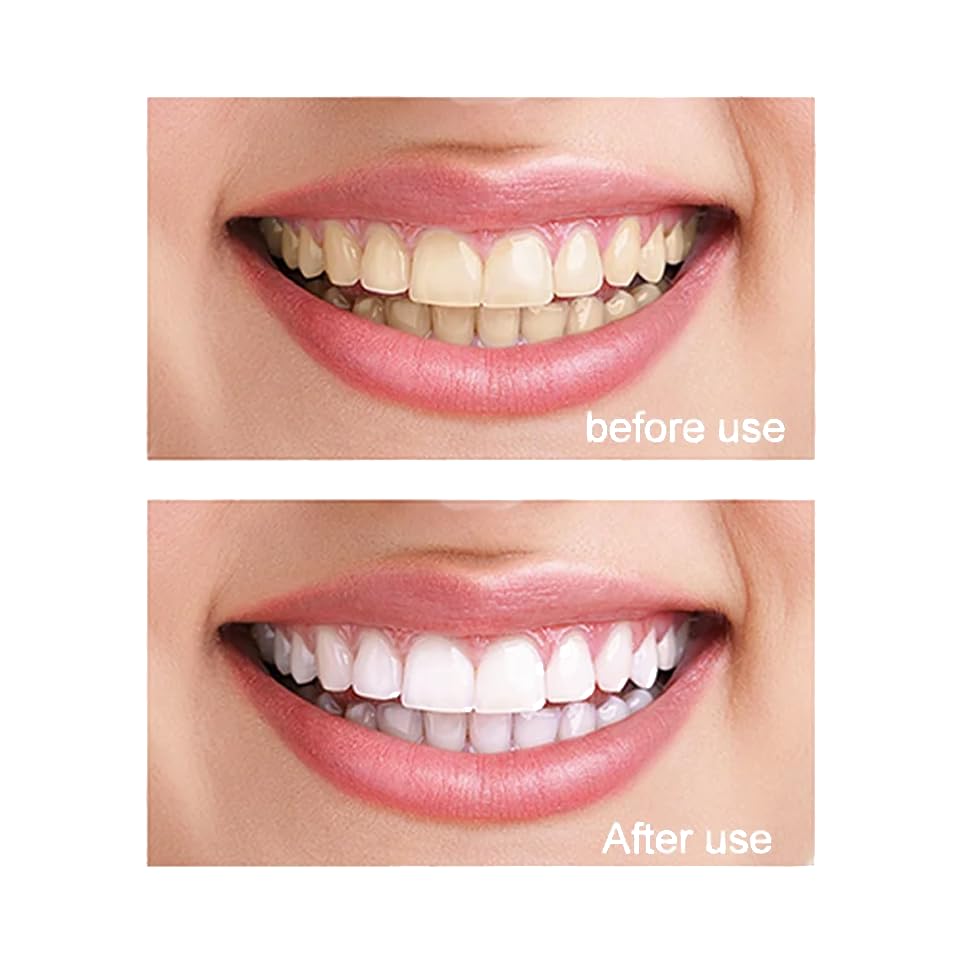 Microcrystalline Hydroxyapatite Powder MCHA – Non-Nano, Fine Powder 30g for DIY Tooth Powder