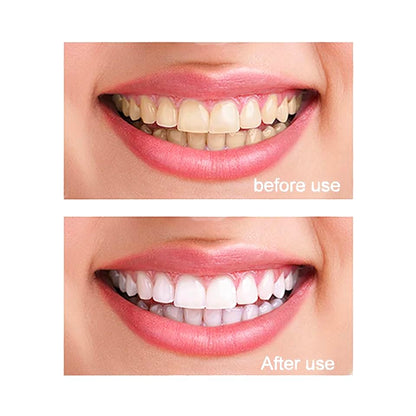 Microcrystalline Hydroxyapatite Powder MCHA – Non-Nano, Fine Powder 30g for DIY Tooth Powder