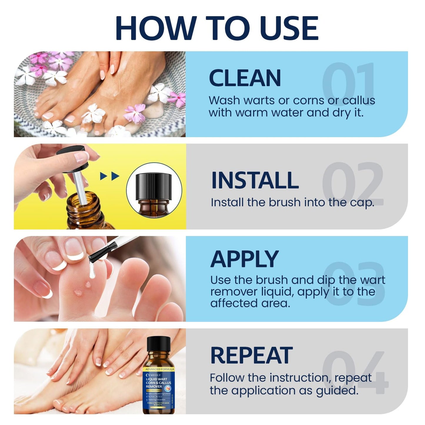 MEOLY Fast-Acting Wart Remover Freeze Off – Plantar Warts, Corns & Calluses, 30 ml