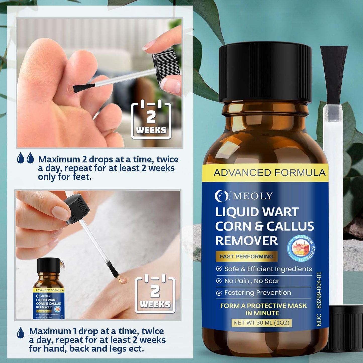 MEOLY Fast-Acting Wart Remover Freeze Off – Plantar Warts, Corns & Calluses, 30 ml
