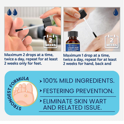 MEOLY Fast-Acting Wart Remover – 40% Salicylic Acid for Plantar Warts & Corns