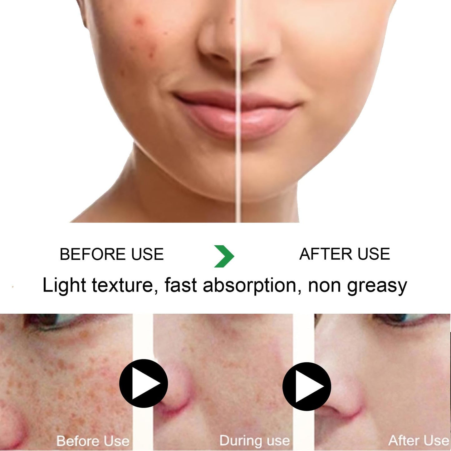 MILIZHIWU Melanina Anti-Melasma Capsule, Skin Brightening Supplement for Hyperpigmentation, Podocarpus Odoratus Extract, Vitamin C & Natural Extracts, Supports Even Skin Tone & Radiance 60 Capsules