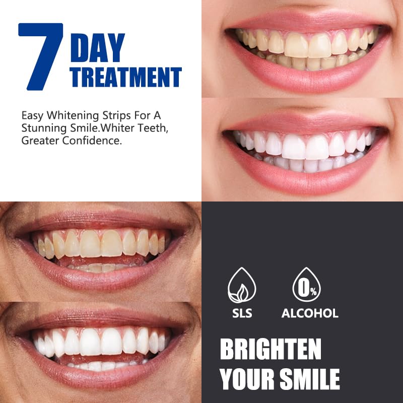 Teeth Whitening Strips – Mint 14-Count | 7-Day Whitening Kit