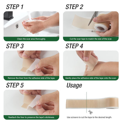 Mitreal Silicone Scar Sheets Roll – 1.6" x 120" Medical-Grade Scar Tape for Surgical Scars (3M Roll)