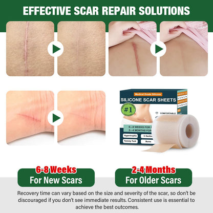 Mitreal Silicone Scar Sheets Roll – 1.6" x 120" Medical-Grade Scar Tape for Surgical Scars (3M Roll)