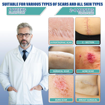 Mitreal Silicone Scar Sheets & Tape — 1.6x158 Roll for Surgical Scars & Keloids