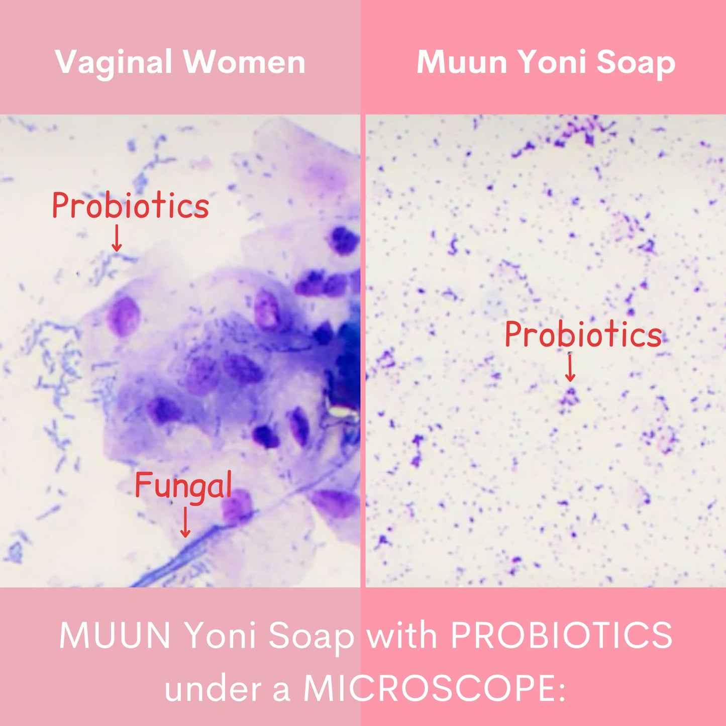 Muun Strawberry Yoni Soap Bar - 3-Pack | pH Balancing Cleanser with Probiotics & Natural Ingredients