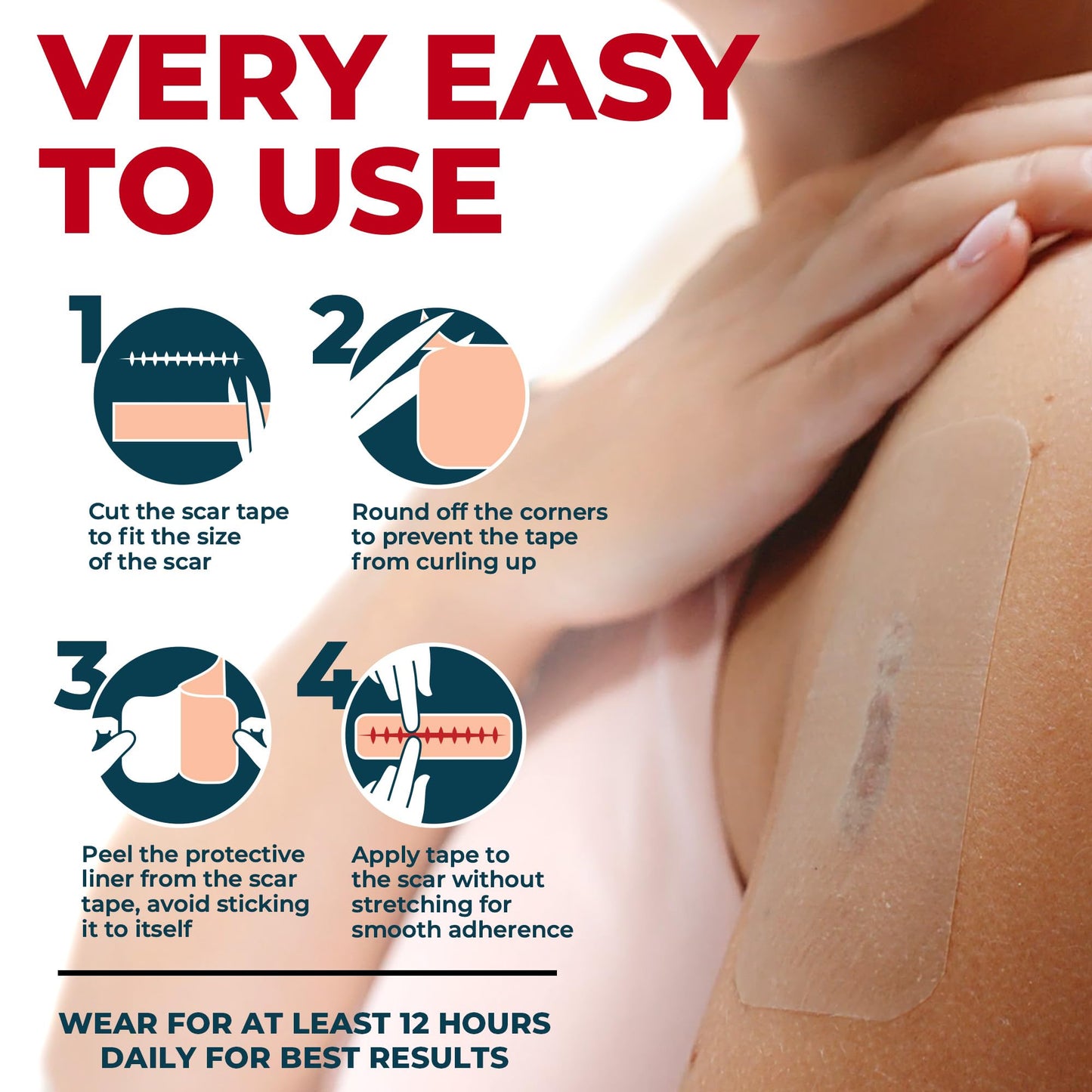 MYHELP Medical Grade Silicone Scar Sheets - Transparent 6pk (5.7x1.6 in) | Visible Difference