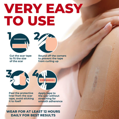 MYHELP Medical Grade Silicone Scar Sheets - Transparent 6pk (5.7x1.6 in) | Visible Difference
