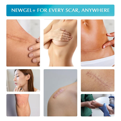 MyNewGel Plus Advanced Silicone Scar Sheets 1x6 Beige 4 Count